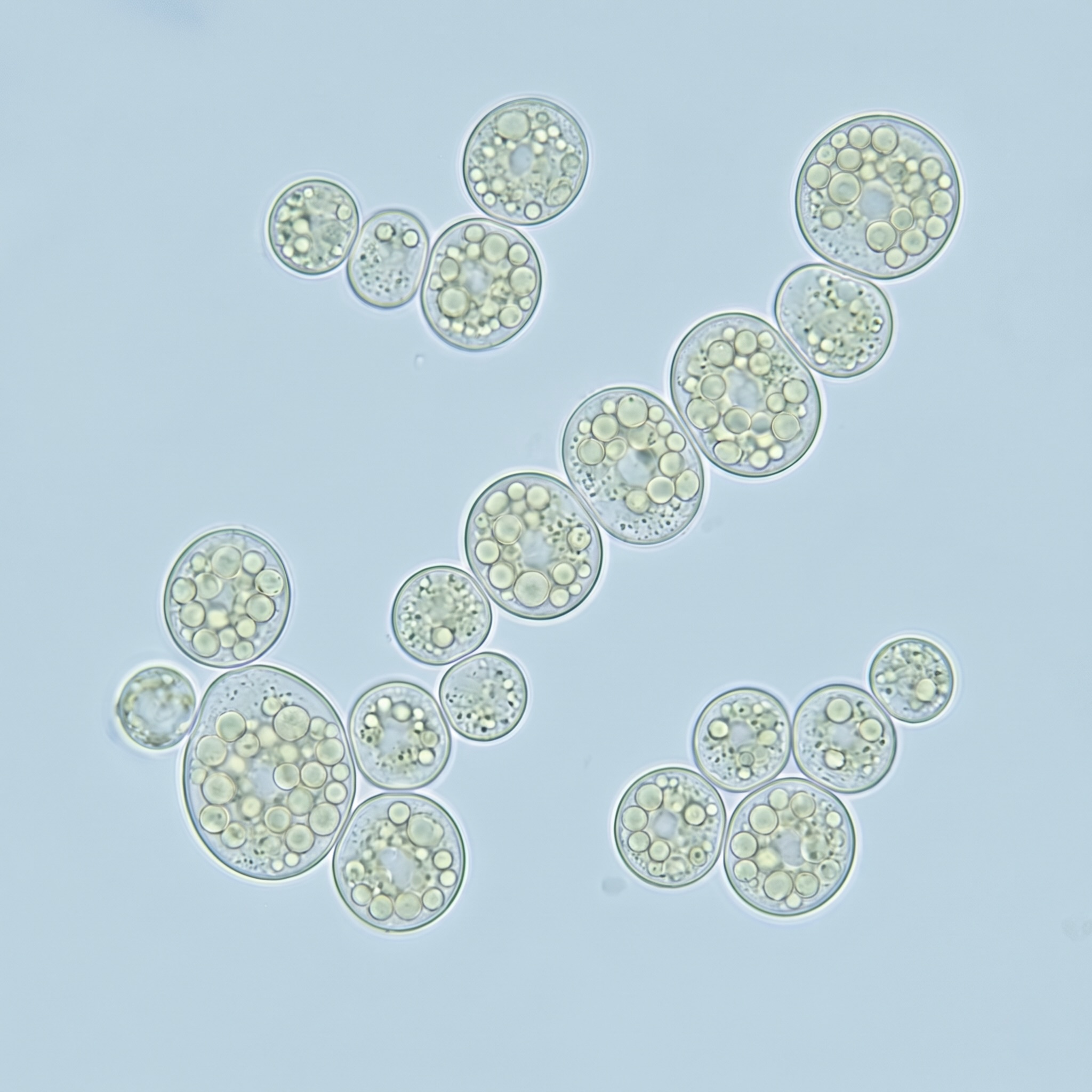 Schizochytrium — Mikroalgen-Kultur, DHA-Quelle